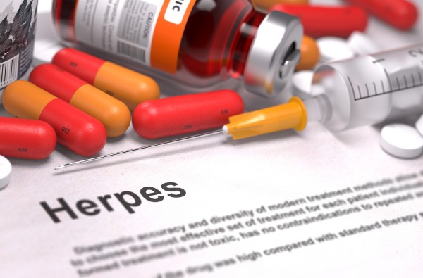 herpes